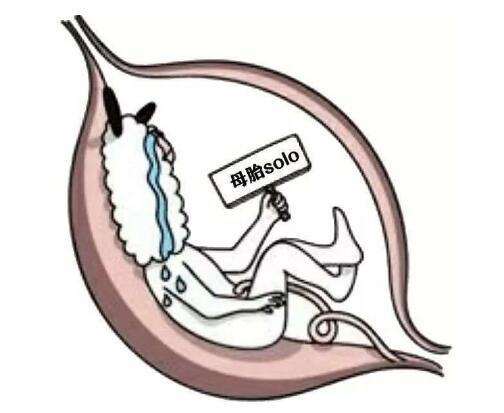 ĸ̥solo��ʲô��˼